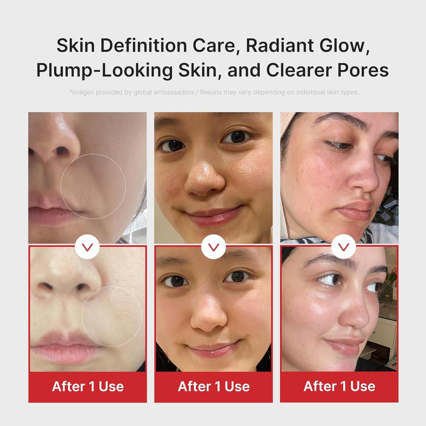 現貨｜Medicube - Age-R Booster Pro 6 in1 多功能美容儀 韓國人氣美容機 一機多用【平行進口｜約1個工作日內寄出】